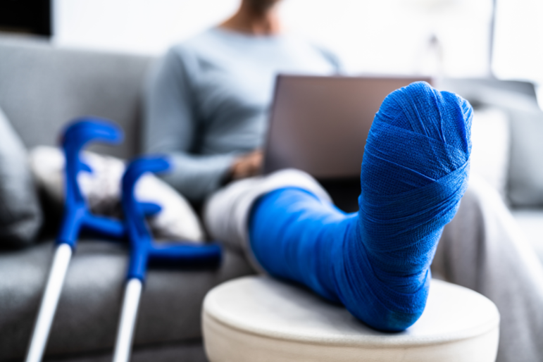 Junger Mann mit gebrochenem Bein und blauem Gips sitzt auf dem Sofa mit einem Laptop
